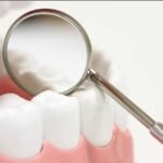 How Long Can a Temporary Crown Last?